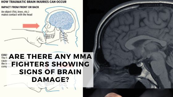 You are currently viewing Are There Any MMA Fighters Showing Signs Of Brain Damage?